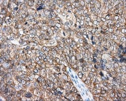 DNTTIP1 / TDIF1 Antibody (clone OTI1E2)