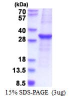 Human SOCS3 Protein (Recombinant His)