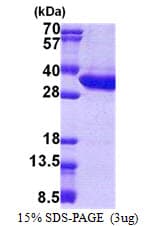 Human KIAA0152 / MLEC Protein (Recombinant His)