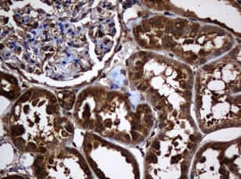 PAI-RBP1 / SERBP1 Antibody (clone OTI2E11)