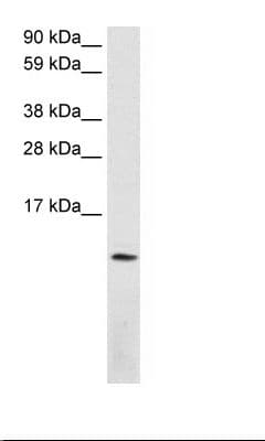 Polyclonal Rabbit anti-Human SDF1 / CXCL12 Antibody (C-Terminus, IHC, WB)