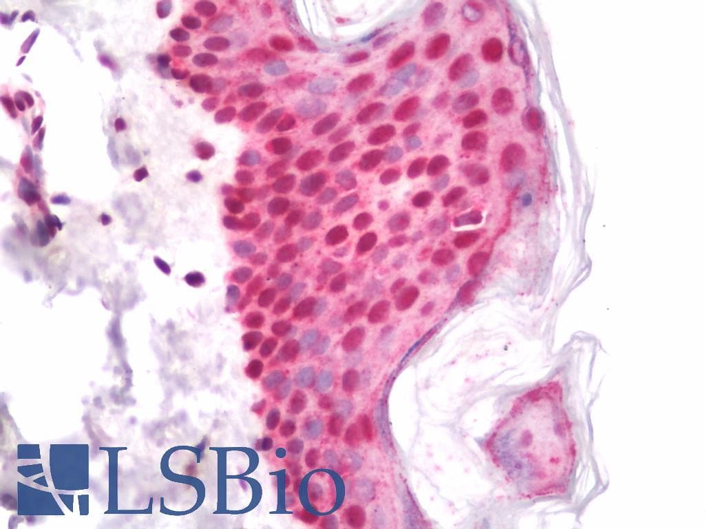 IHC-plus™ Polyclonal Rabbit anti-Human SIK1 / MSK Antibody (aa148-197, IHC, WB)