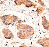 Polyclonal Rabbit anti-Human GJA1 / CX43 / Connexin 43 Antibody (aa107-138, IHC, WB)