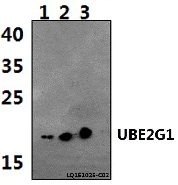 UBE2G1 Antibody