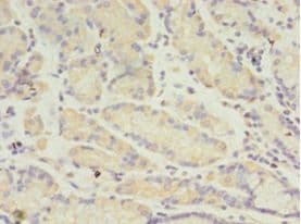 IHC-plus™ ANGPTL2 / ARP2 Antibody (aa23-493)