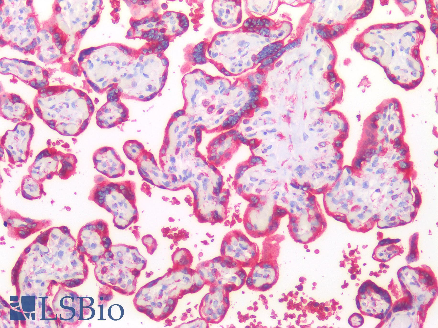 IHC-plus™ HSPA5 / GRP78 / BiP Antibody (clone 1672CT323.22.82)