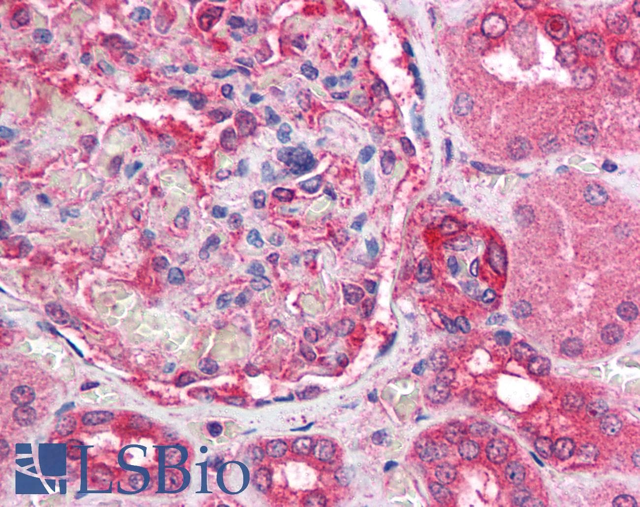 IHC-plus™ ATM Antibody (aa980-1512, clone 3E8, Preservative Free)