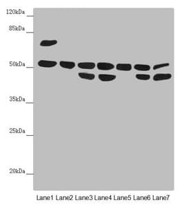 CDCA1 / NUF2 Antibody