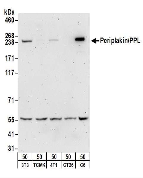 IHC-plus™ PPL / Periplakin Antibody (aa1150-1200)