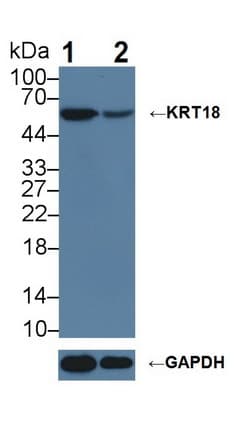 KRT18 / CK18 / Cytokeratin 18 Antibody (aa1-423)
