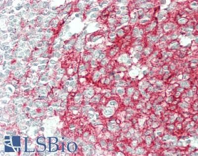 IHC-plus™ Polyclonal Rabbit anti-Human CLU / Clusterin Antibody (Glu436, IHC, IF, WB)