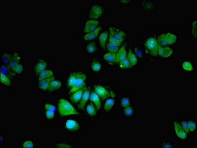 Polyclonal Rabbit anti-Human MLX / TCFL4 Antibody (IHC)