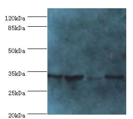 METRNL Antibody (aa46-311)