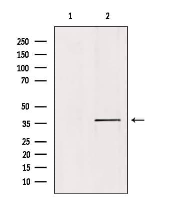 PRKACA Antibody