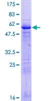 Human CENPP Protein (Recombinant GST)
