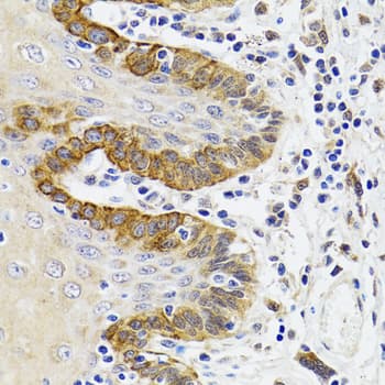 Esterase D / ESD Antibody