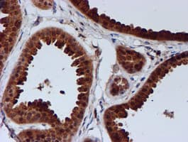 C1orf50 Antibody (clone OTI1C6)