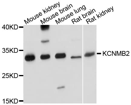 Polyclonal Rabbit anti-Human KCNMB2 Antibody (WB)