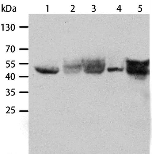 KRT19 / CK19 / Cytokeratin 19 Antibody