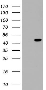 Monoclonal Mouse anti-Human TRIM54 / MURF Antibody (clone OTI6C3, aa166-400, WB)