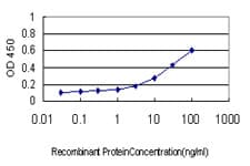 Monoclonal Mouse anti-Human R1 / RRM1 Antibody (clone 4E4, WB)