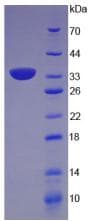Rat CTGF Protein (Recombinant His)