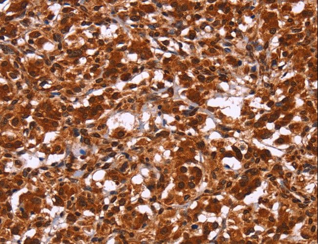HIPK1 Antibody