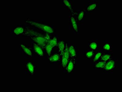 POLDIP2 / PDIP38 Antibody