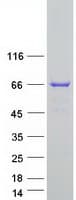 Human JRK Protein (Recombinant Myc-DDK (Flag))