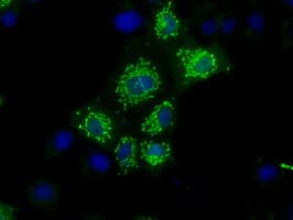 NIT1 Antibody (clone OTI4D12)