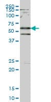 SMAD2 Antibody (clone 4D10)