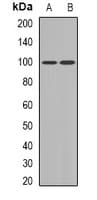 UBTF / UBF Antibody (Internal)