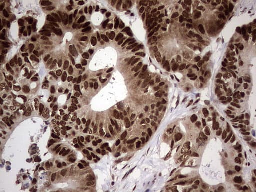 C14orf166 Antibody (clone OTI1B2)