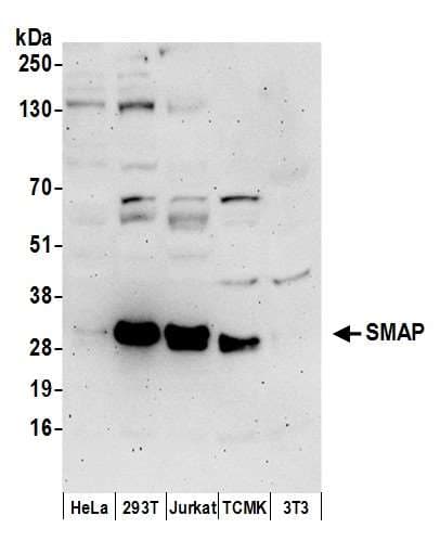 Polyclonal Rabbit anti-Human C11orf58 Antibody (aa1-50, WB)