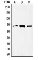 FOXO1 / FKHR Antibody (Internal)