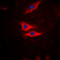 Polyclonal Rabbit anti-Human PLA2G4A Antibody (phospho-Ser505, IHC, IF, WB)