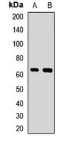 Polyclonal Rabbit anti-Human LILRB2 / ILT4 Antibody (IHC, WB)