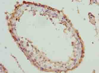 MOV10 Antibody