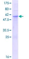 Human CHODL / Chondrolectin Protein (Recombinant GST)