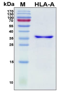Human HLA-A Protein (Recombinant His, N-Terminal)