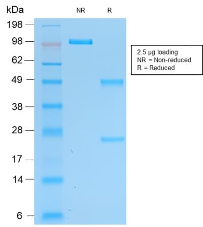 UCHL1 / PGP9.5 Antibody (clone rUCHL1/775)