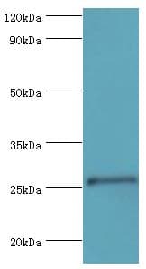 Polyclonal Rabbit anti-Human TFPI2 Antibody (aa23-235, IHC, WB)