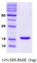 Human SNCA / Alpha-Synuclein Protein (Recombinant)