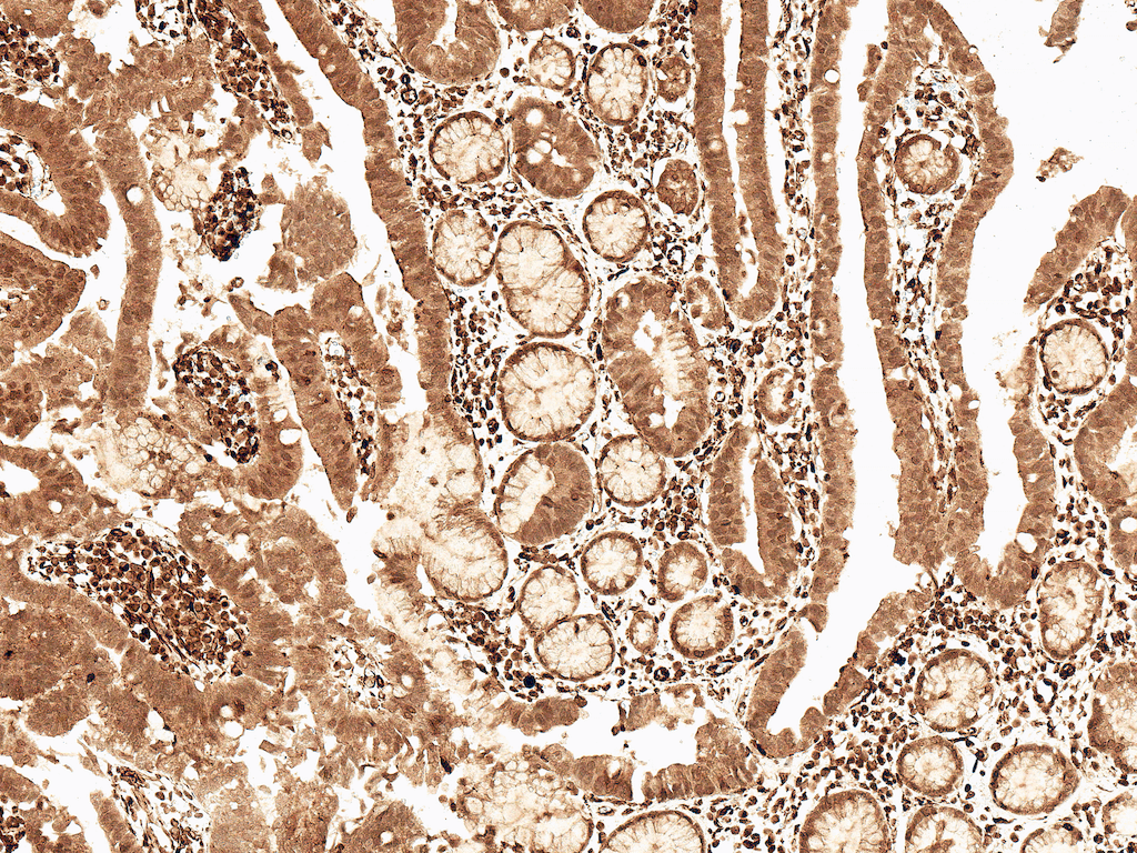 CCND2 / Cyclin D2 Antibody (Biotin)