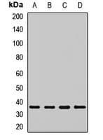 Polyclonal Rabbit anti-Human PSMD14 Antibody (WB)