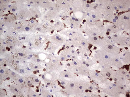 Monoclonal Mouse anti-Human LGALS3 / Galectin 3 Antibody (clone OTI2F1, Carrier-free, IHC, WB)
