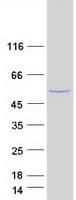 Human PAX2 Protein (Recombinant Myc-DDK (Flag))