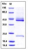 Human IL23 Protein (Recombinant His,C-terminus)
