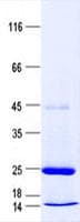 Human C7orf33 Protein (Recombinant His, N-Terminal)