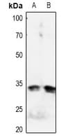 IGFBP3 Antibody